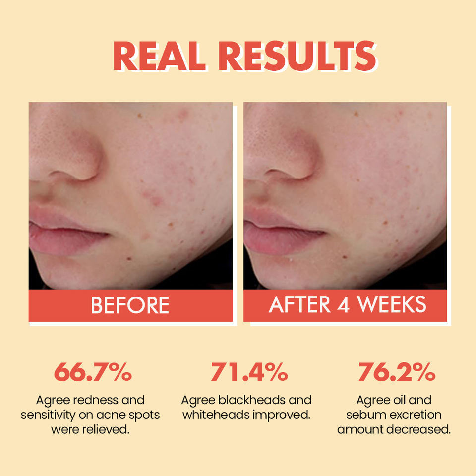 OEM ODM anti-aging skin care facial essence oil private label Organic skin care product Rosehip anti wrinkle plump facial whitening oil