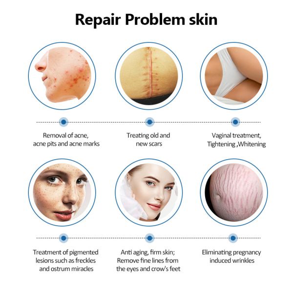 12.1 Inch Touch Screen Scar Remodeling Skin Firming 10600nm  Fractional CO2 Laser Machine