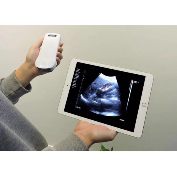 Блок развертки ультразвука кармана Handheld с Wifi подключил с элементами портативной машинки 128 ультразвука Doppler мобильного телефона IPad