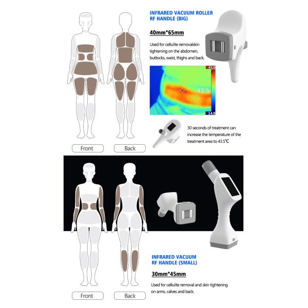 Machine de réduction de graisse par radiofréquence et cavitation sous vide VelaBody, machine de remodelage corporel et de perte de poids sous vide