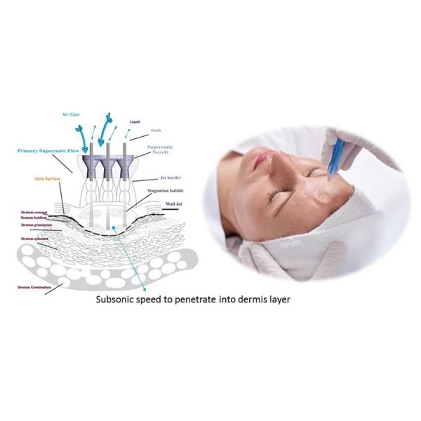 Get a Clean and Glowing Face with Our CE Certified Oxygen Jet Peel Facial Machine