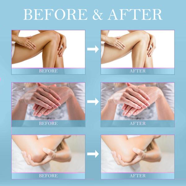 OEM Dark Spot Corrector Cream Underarm, Neck, Armpit, Knees, Elbows, Private Areas