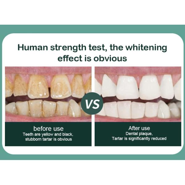 Перевозчика металлической пластинкы Wifi уборщик зуба видимого ультразвуковой электрический с удалением расчета камеры зубоврачебным