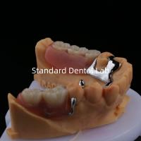 Métal allié cadre de prothèse partielle 3 forme Exocad Impression au laser finition partielle en fonte inférieure