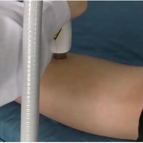 Pain Free Laser Hair Removal Machines 12*12mm Spot SHR Laser 808nm Fiber Laser Hair Removal Machine