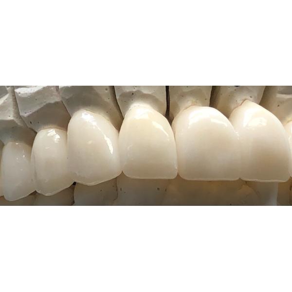 Multilayer Dental Lab 3D Pro Zirconia Disc B1 D98*16mm For CAD CAM Milling