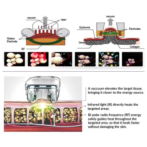Vacuum Cavitation RF  Slimming Machine Fat Removal Face Lift 40k 80k