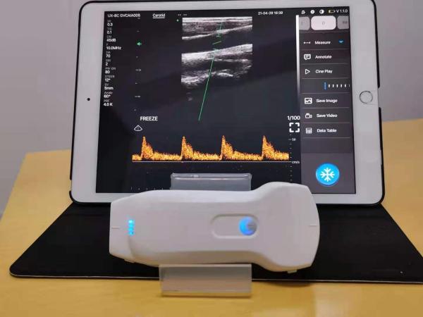 Dual Portable Wireless Ultrasound Liner Probe 3 in 1