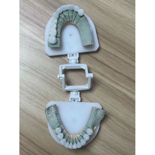 Full Zirconia dental bridge for high strength and durable dental restoration