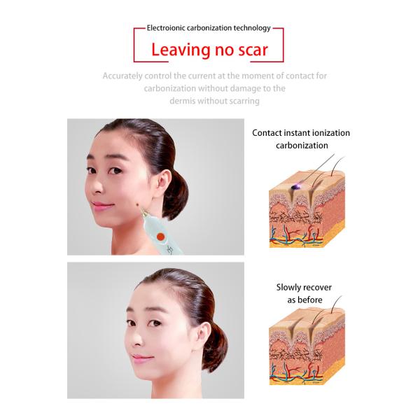 Plasma Eyelid Lifting Beauty Skin Rejuvenation Machine 220V For Wart Nevus Removal