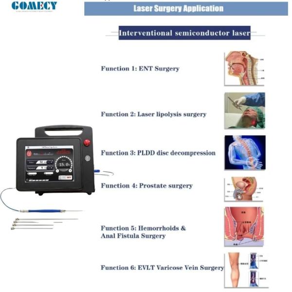 15W/20W 1470nm Endolaser for Liftinging Facial Lipolysis and Endovenous Laser Spider Vein Removal 3 Meters Fiber