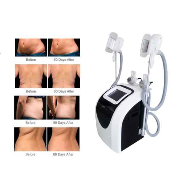 Home Fat Reduction Equipment  Supprted By Patent Anti  -  Cold Damage Technology