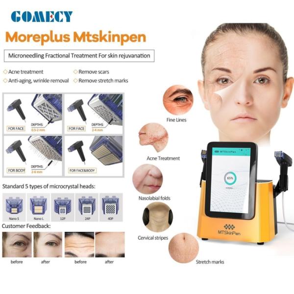 Золотая фракционная микроигла для красоты микроигла для подъема для очистки кожи