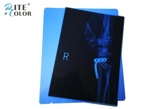 Película de raios X médica PET azul à prova d'água para ressonância magnética CT CR