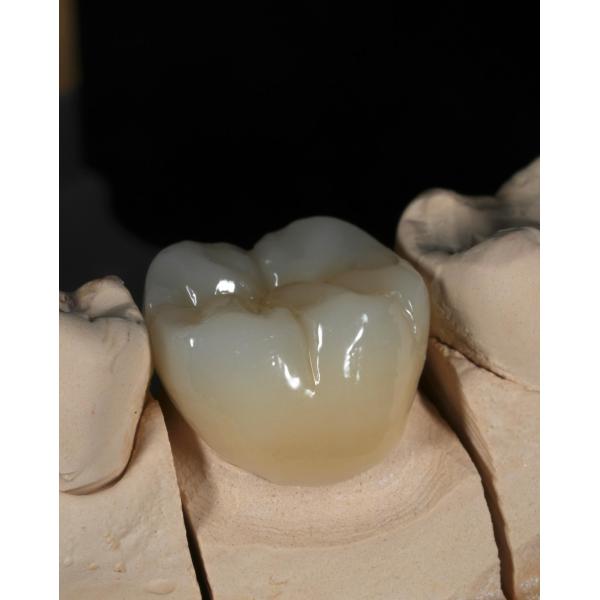 Полный контур циркониевой короны быстрое поворотное устройство для точной и эстетической настройки за 1 неделю