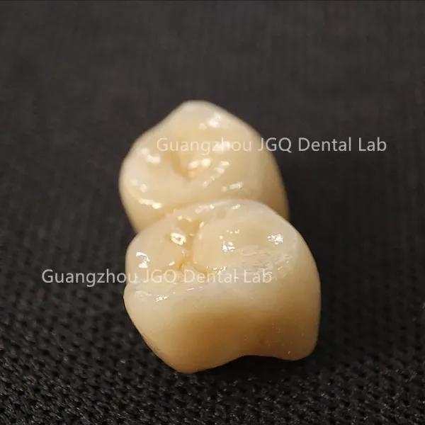 Zirconia Dentures Teeth Dental Lab Single Crown Anterior Posterior Dental Restoration