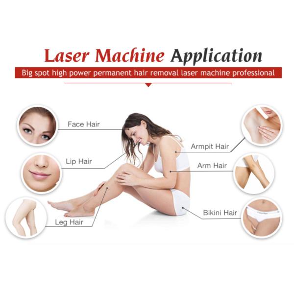 808nm 810nm Mobile Laser Hair Removal Machine Permanent 600w 10 Bars