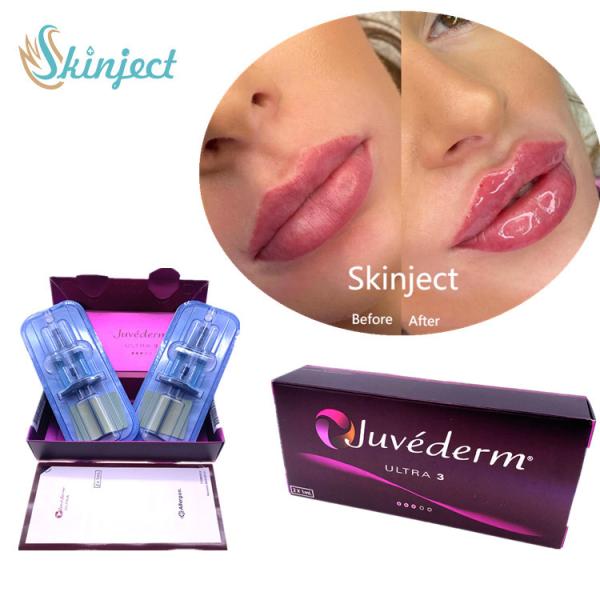 Кислота Juvederm Ultra3 вводимая Hyaluronic для заполнителя дермального 2x1ml губы