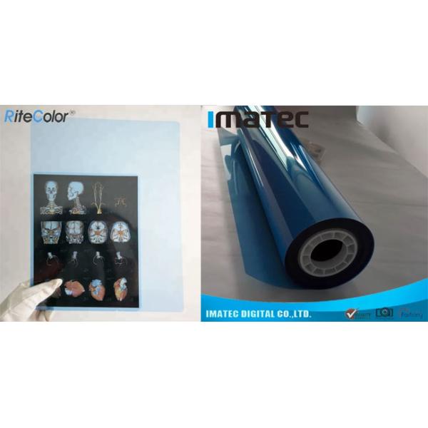 А4 медицинская чернила сухой рентгеновской визуализации синяя пленка для медицинских изделий