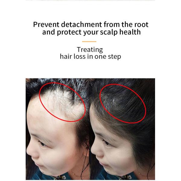 30ml Hair Growth Serum