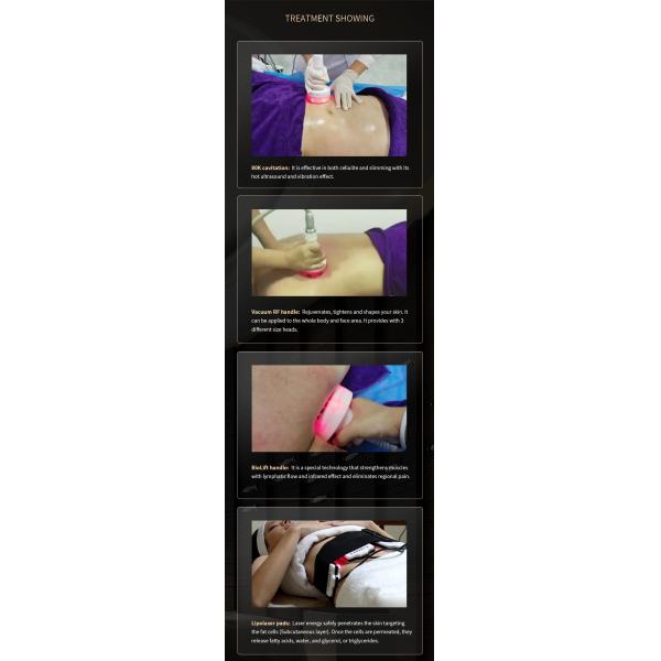 Машина 6 кавитации вакуума RF в 1 коже 40K затягивая формирующ оборудование красоты