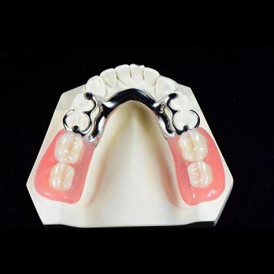 Premium Full Metal Frame Denture Co Cr Framework Cobalt Chromium Alloy