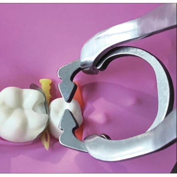 Dental Sectional Matrix System Clamp Ring R1