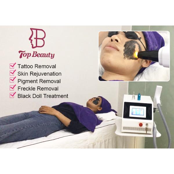 Portable 532nm 1320nm 1064nm Q cambió la eliminación de tatuajes de la máquina láser Nd Yag