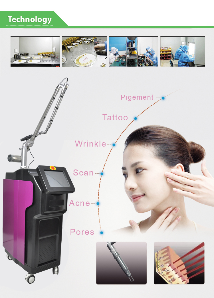 OEM машины удаления татуировки лазера Nd Yag Picosure пикосекунды для салона