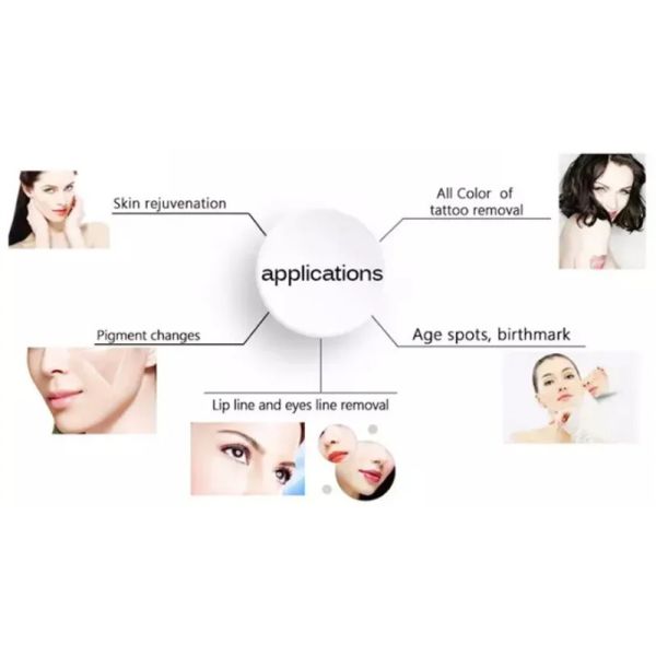 Прибор удаления пигмента удаления татуировки лазера Nd Yag случая большой силы небольшой