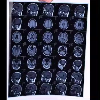 Medical X Ray Film Dry Thermal For Printer