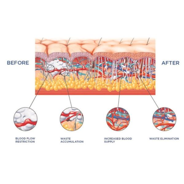 Внекорпусное тело облегчения боли приборов терапией ударной волны CE уменьшая машину красоты