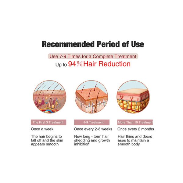 Safety Acne Clearance SR 560nm Laser Hair Removal System