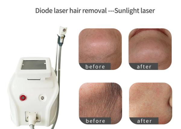 10 Bars 808nm Diode Laser Hair Removal Machine With Copper Heat Radiation System