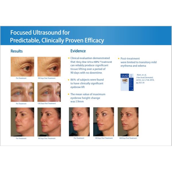 Best Facial Skin Lifting Wrinkel Remover Ultrasound HIFU/ Portable HIFU Slimming Machine