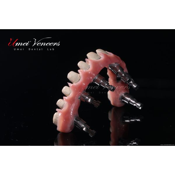 Good biocompatibility zirconia bridge