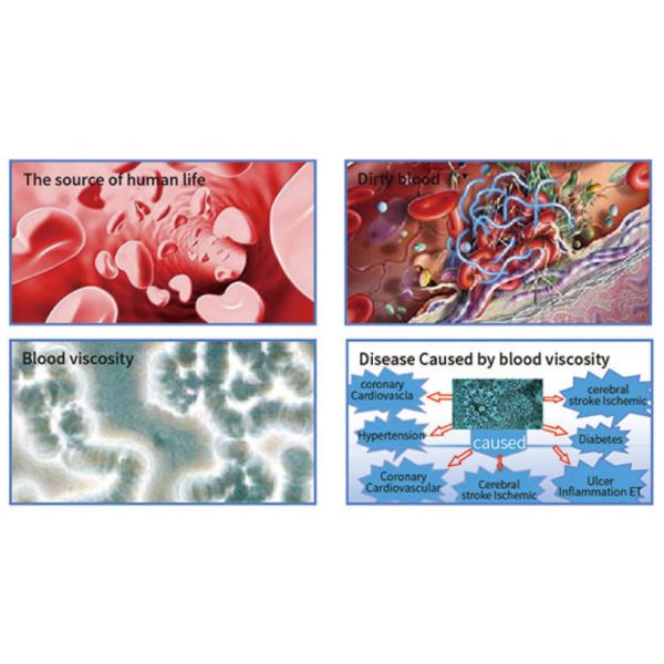 450nm 26 Diodes Wrist Low Level Cold Laser Therapy Devices For Diabetes Type II