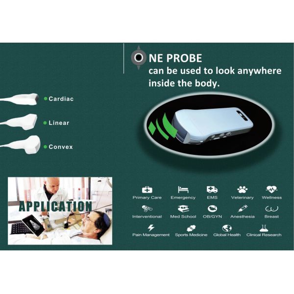 128 Elements Medical Hospital Equipments Color Doppler Portable Wireless Ultrasound Machine 3 In 1