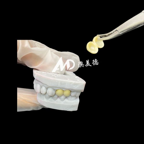 Zirconia Dental Crown with High-Quality Materials and Precise Laboratory Fabrication for Long-Lasting, Esthetic Restorations