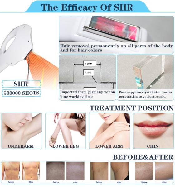 Factory price elight hair removal skin rejuvenation beauty salon equipment ipl shr with fda ce
