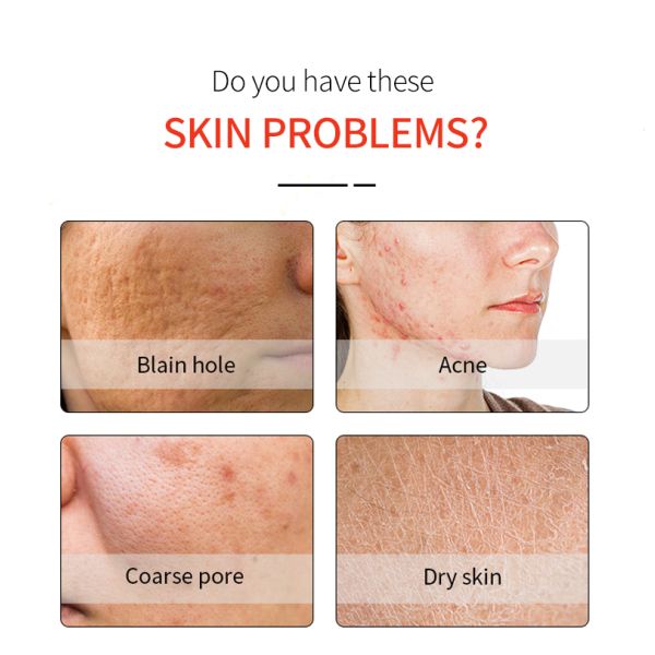 OEM Facial Serum Whitening Anti Wrinkle Vitamin C Serum For Face