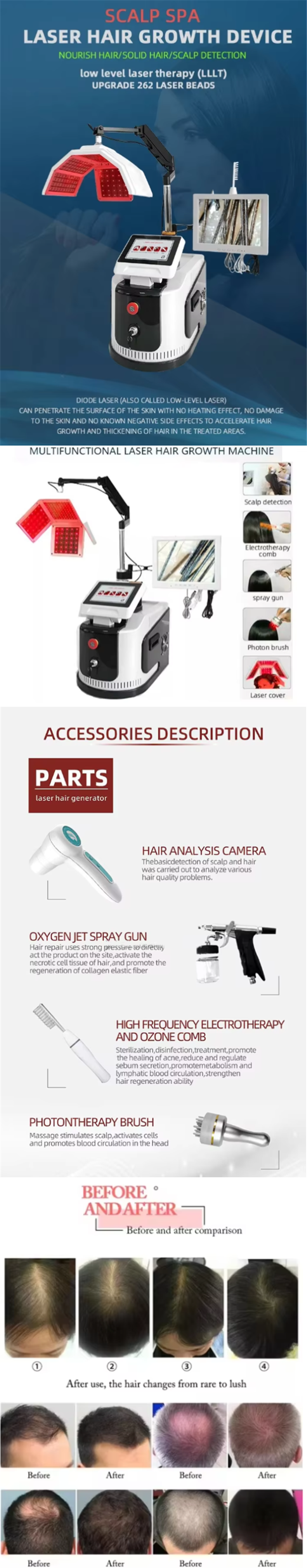 5 in 1 Multifunctional Scalp Care Laser Hair Growth Machine For Professional Salon