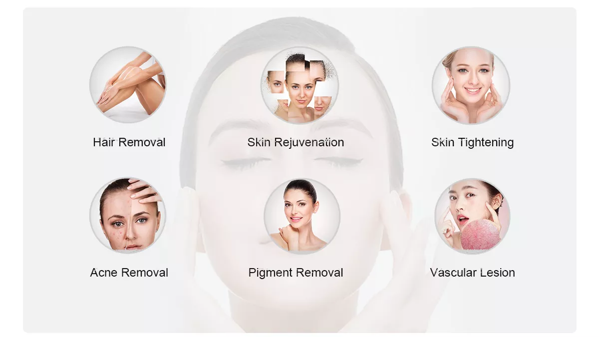 Многофункциональные 3 в 1 подмолаживании кожи удаления волос лазера OPT DPL IPL постоянном/васкулярной машине удаления