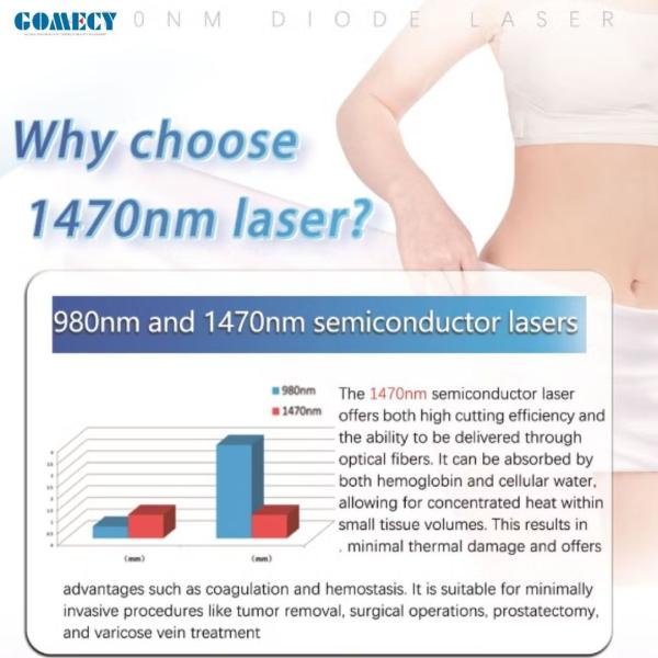 Professional 1470 Nm 980 Nm Diode Laser Lipolysis Machine Fat Loss Liposuction Vascular Varicose Veins Removal For Dental Clinic