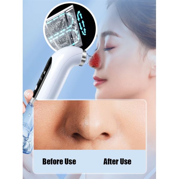 Private Label Blackhead Removal Professional Blackhead Remover for Face Acne Treatment