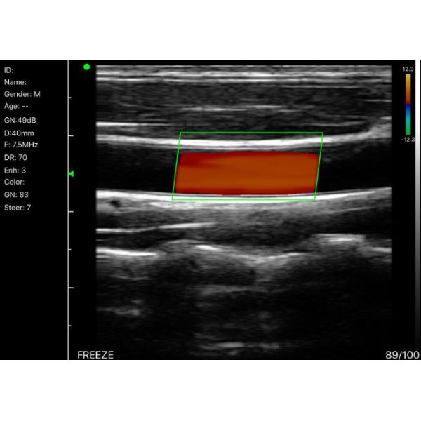 Зонда ультразвука зонда ультразвука кармана элементы 2.4G Wifi веса 235g 128 ультразвука беспроводного Handheld мини только