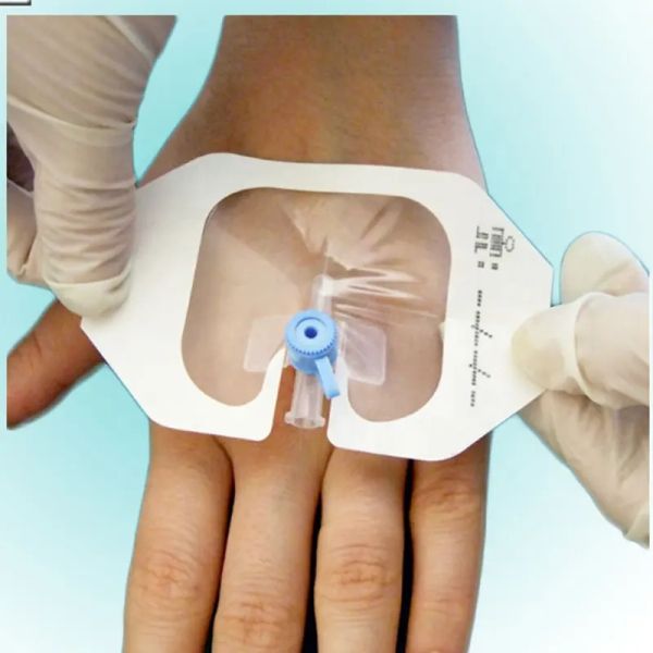 Molho transparente do Iv Cannulae do molho sem fôlego cirúrgico do plutônio em forma de u