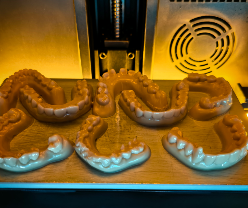 Model Resin Dental Digital Dentistry Workflows Modern Oral Restoration Precision Molding Capabilities