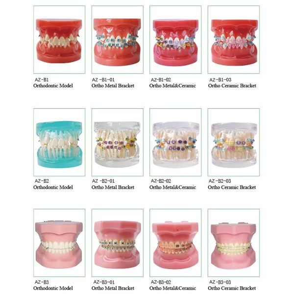 Dental Typedont Dentes Modelo Para Preparação Dental Estudante Ortodontia Prática Modelo
