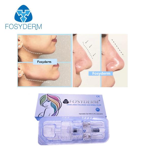 Remplisseur de sodium de gel d'acide hyaluronique pour la lèvre 1.1ml injectable